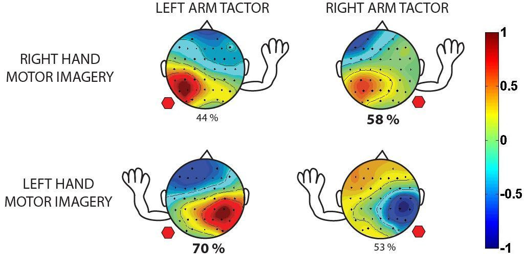 ¿Qué es la “visualización motora” (motor imagery)? TRAUMATRUCOS